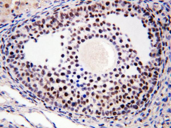 MTA1 Antibody in Immunohistochemistry (Paraffin) (IHC (P))