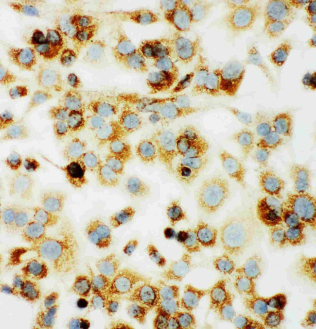 MTCO1 Antibody in Immunocytochemistry (ICC/IF)