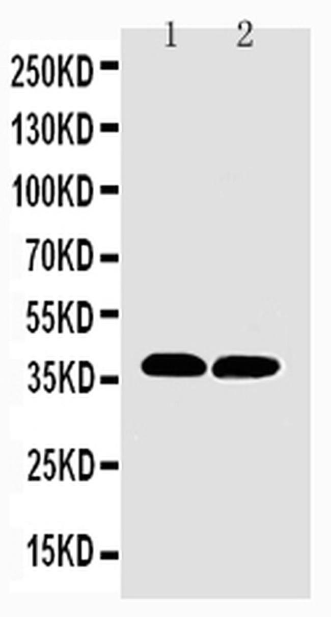 MTCO1 Antibody in Western Blot (WB)