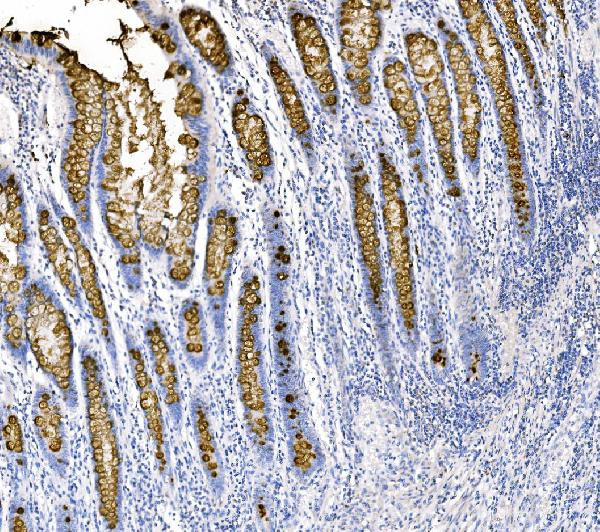 MUC2 Antibody in Immunohistochemistry (Paraffin) (IHC (P))