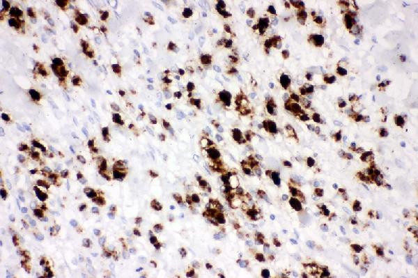 MUC5AC Antibody in Immunohistochemistry (Paraffin) (IHC (P))