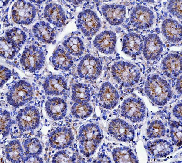 MUC5AC Antibody in Immunohistochemistry (Paraffin) (IHC (P))