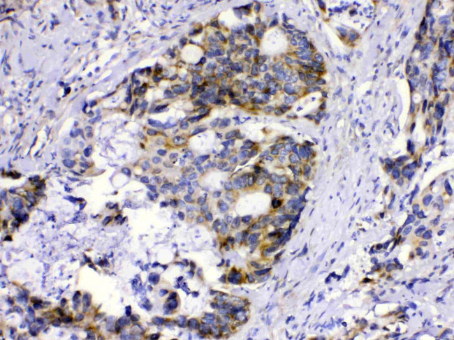 MUT Antibody in Immunohistochemistry (Paraffin) (IHC (P))