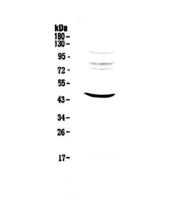 MVD Antibody in Western Blot (WB)