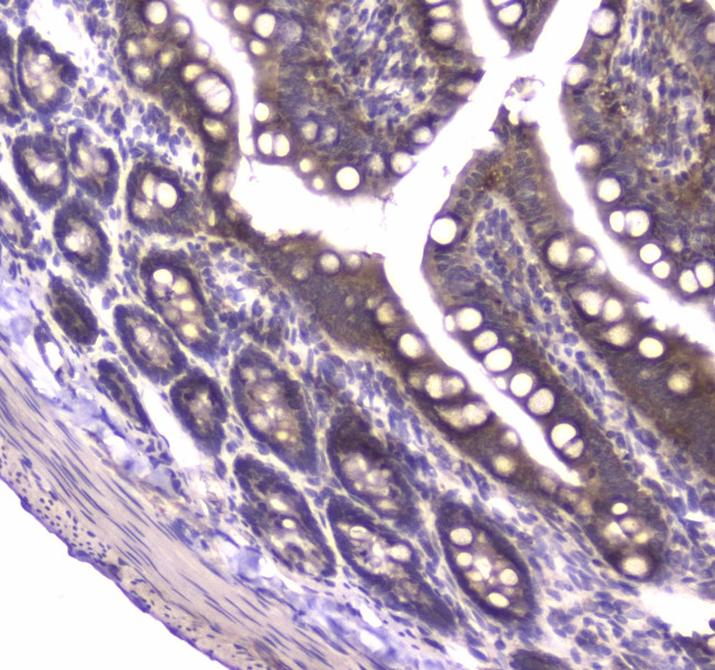 MVP Antibody in Immunohistochemistry (Paraffin) (IHC (P))