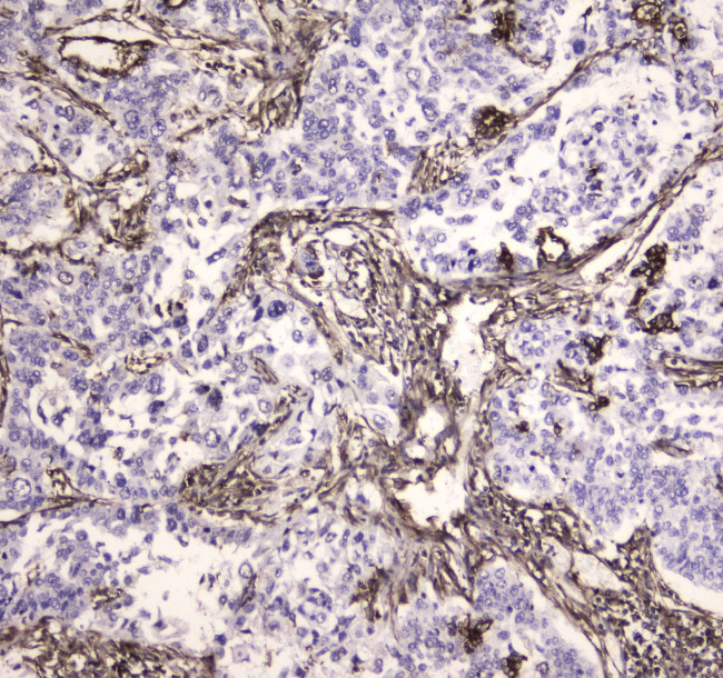 MVP Antibody in Immunohistochemistry (Paraffin) (IHC (P))