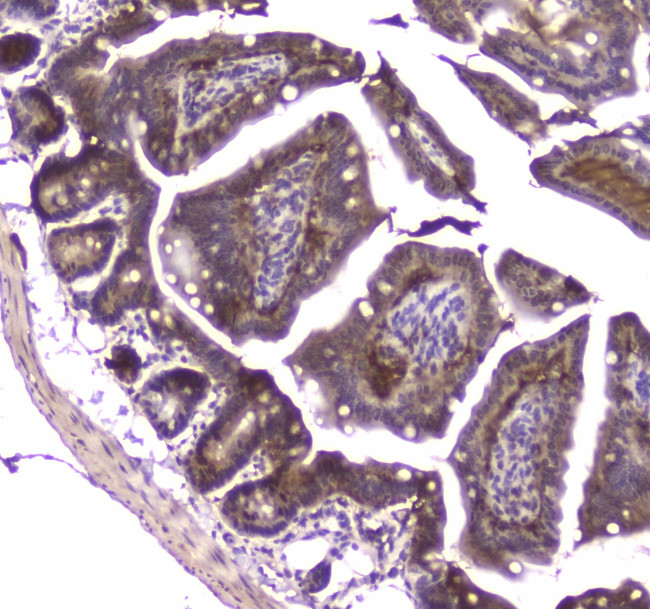 MVP Antibody in Immunohistochemistry (Paraffin) (IHC (P))