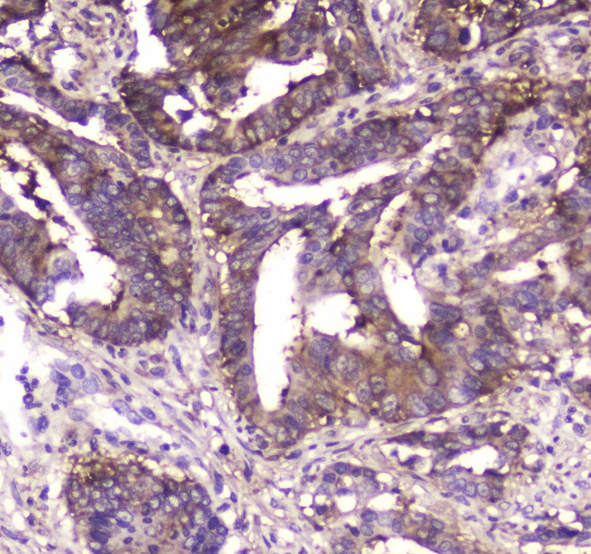 MVP Antibody in Immunohistochemistry (Paraffin) (IHC (P))