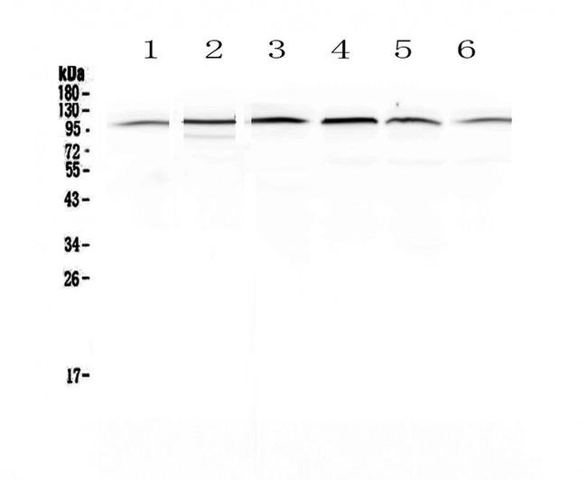 MVP Antibody in Western Blot (WB)