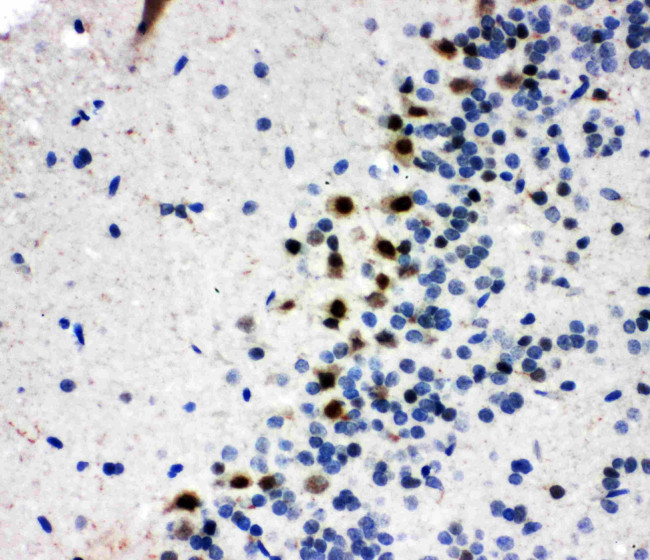 B-Myb Antibody in Immunohistochemistry (Paraffin) (IHC (P))