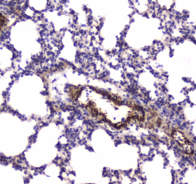 MYLK Antibody in Immunohistochemistry (Paraffin) (IHC (P))