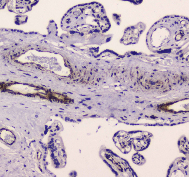 MYLK Antibody in Immunohistochemistry (Paraffin) (IHC (P))