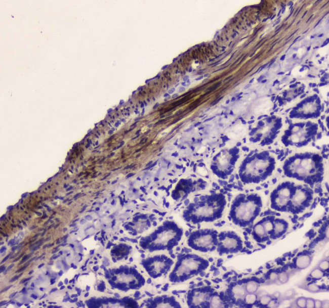 MYLK Antibody in Immunohistochemistry (Paraffin) (IHC (P))