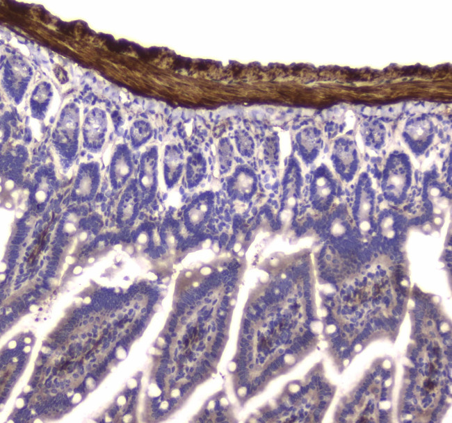 MYLK Antibody in Immunohistochemistry (Paraffin) (IHC (P))