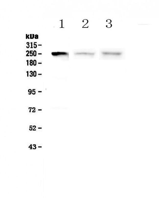 MYLK Antibody in Western Blot (WB)