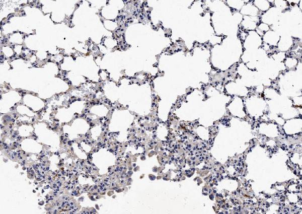 NKp46 (CD335) Antibody in Immunohistochemistry (Paraffin) (IHC (P))