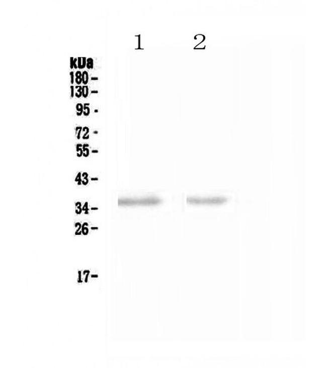 NKp46 (CD335) Antibody in Western Blot (WB)