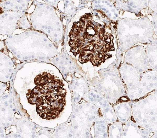 Nestin Antibody in Immunohistochemistry (Paraffin) (IHC (P))