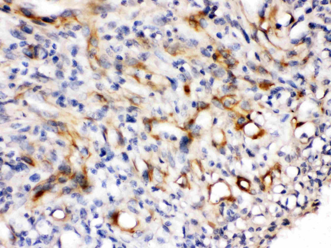 Nestin Antibody in Immunohistochemistry (Paraffin) (IHC (P))