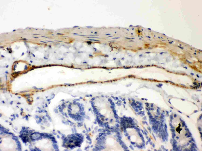 IkB beta Antibody in Immunohistochemistry (Paraffin) (IHC (P))