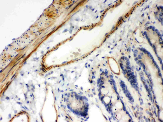 IkB beta Antibody in Immunohistochemistry (Paraffin) (IHC (P))