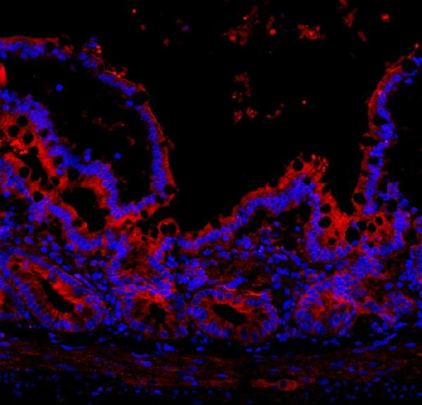 NLRP3 Antibody in Immunohistochemistry (Paraffin) (IHC (P))