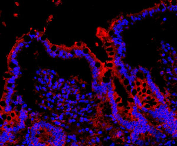 NLRP3 Antibody in Immunohistochemistry (Paraffin) (IHC (P))