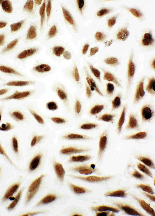 NME2 Antibody in Immunocytochemistry (ICC/IF)