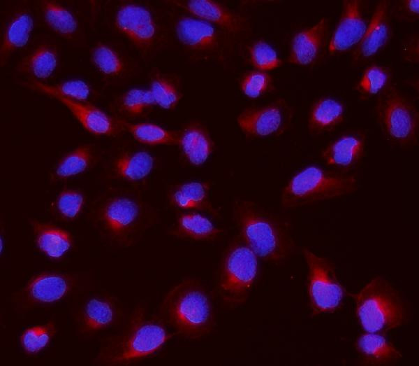 NME2 Antibody in Immunocytochemistry (ICC/IF)