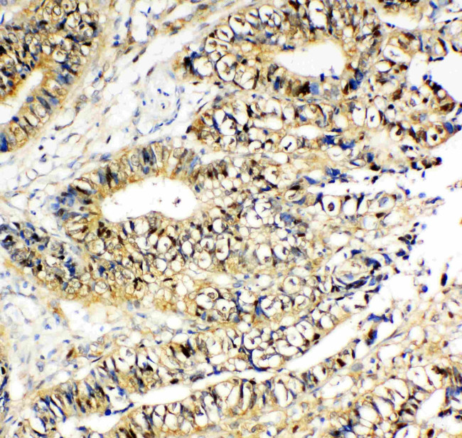 NME2 Antibody in Immunohistochemistry (Paraffin) (IHC (P))