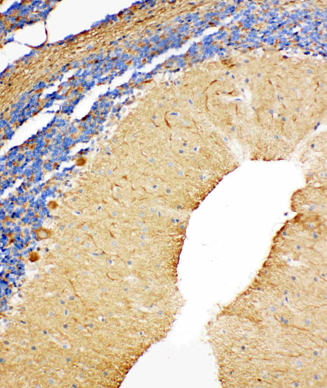 NME2 Antibody in Immunohistochemistry (Paraffin) (IHC (P))