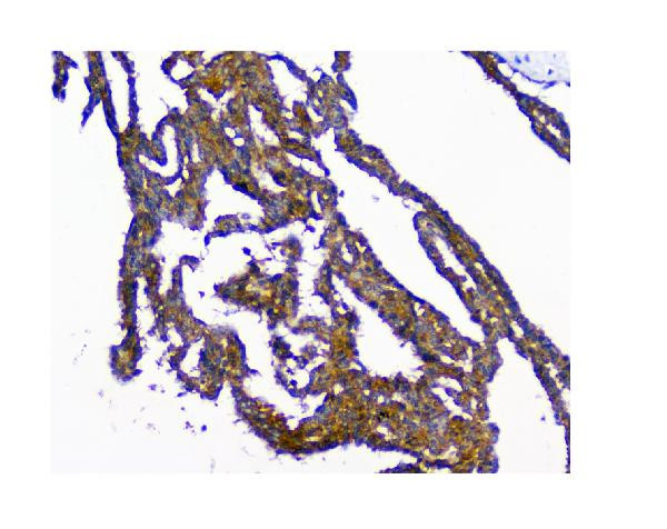 NMI Antibody in Immunohistochemistry (Paraffin) (IHC (P))