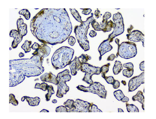 NMI Antibody in Immunohistochemistry (Paraffin) (IHC (P))