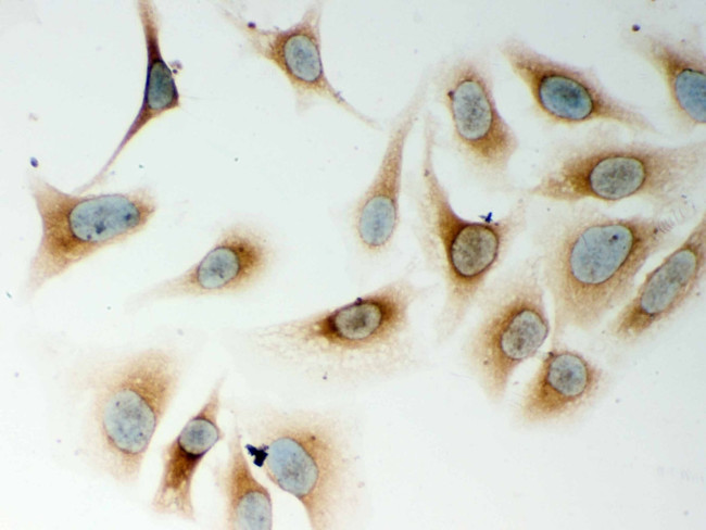 NOD1 Antibody in Immunocytochemistry (ICC/IF)