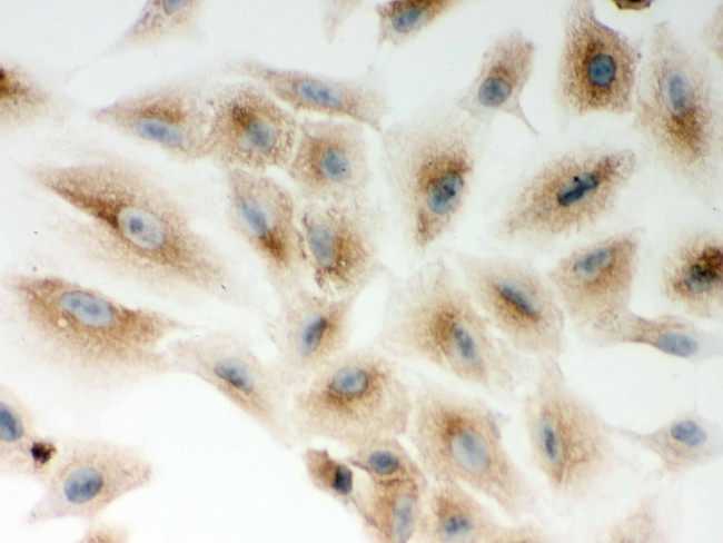 NOD1 Antibody in Immunocytochemistry (ICC/IF)