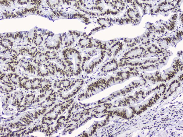 NONO Antibody in Immunohistochemistry (Paraffin) (IHC (P))