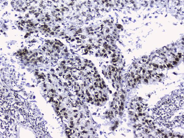 NONO Antibody in Immunohistochemistry (Paraffin) (IHC (P))