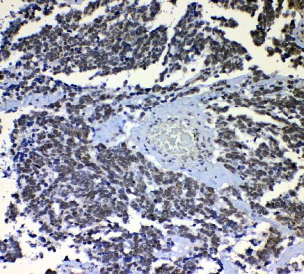 NONO Antibody in Immunohistochemistry (Paraffin) (IHC (P))