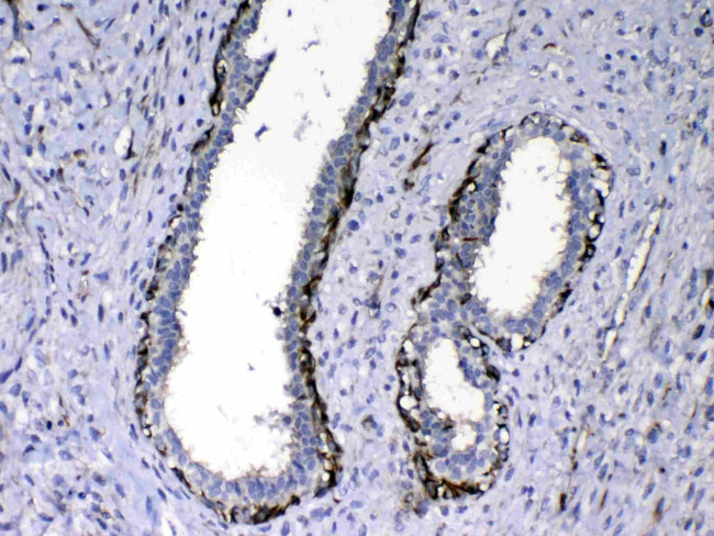 NOV Antibody in Immunohistochemistry (Paraffin) (IHC (P))