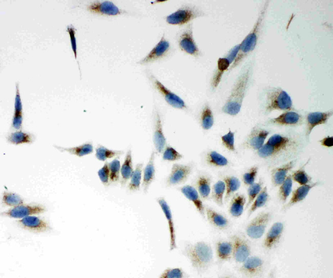 NOX5 Antibody in Immunocytochemistry (ICC/IF)