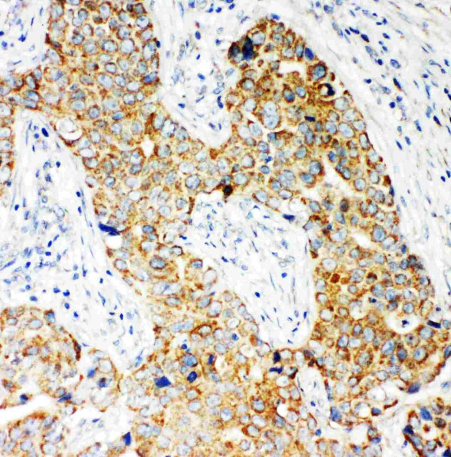 NOX5 Antibody in Immunohistochemistry (Paraffin) (IHC (P))