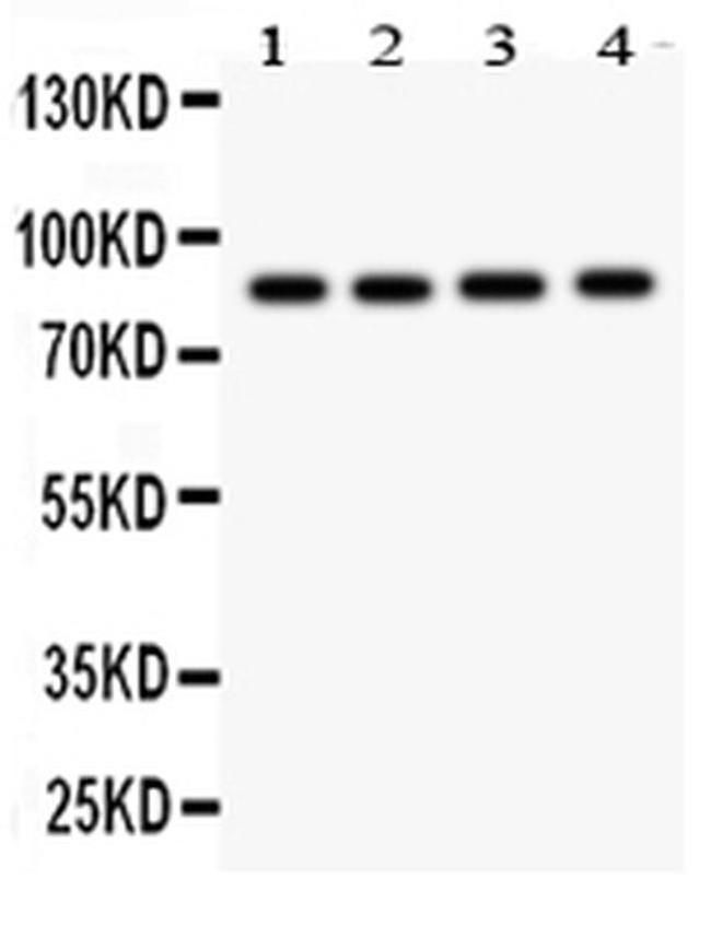 NOX5 Antibody in Western Blot (WB)