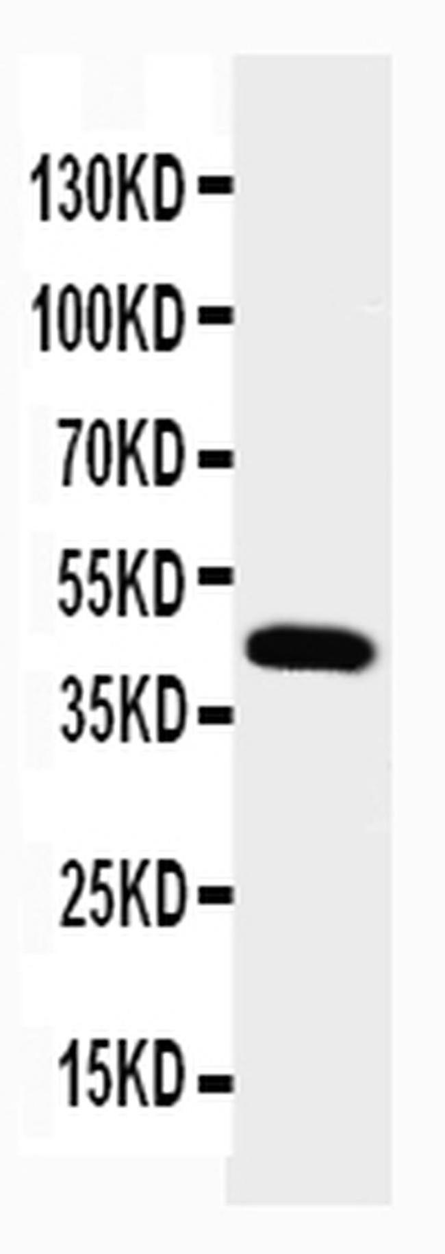 Podocin Antibody in Western Blot (WB)