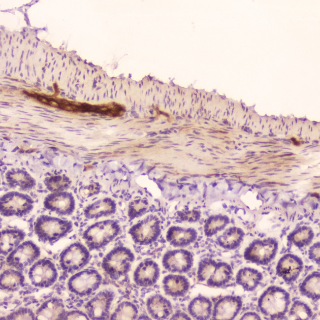 ANP Antibody in Immunohistochemistry (Paraffin) (IHC (P))