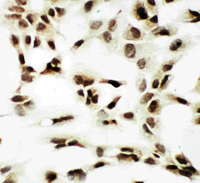 NRF1 Antibody in Immunocytochemistry (ICC/IF)