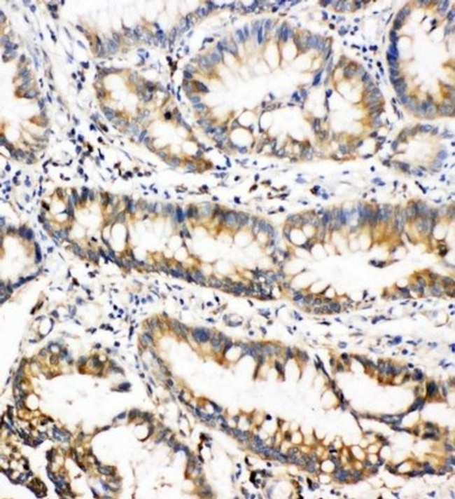 Oncostatin M Antibody in Immunohistochemistry (Paraffin) (IHC (P))