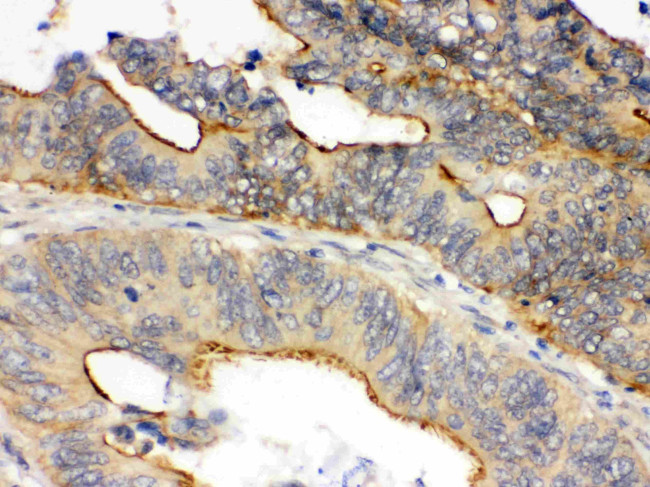 Oncostatin M Antibody in Immunohistochemistry (Paraffin) (IHC (P))