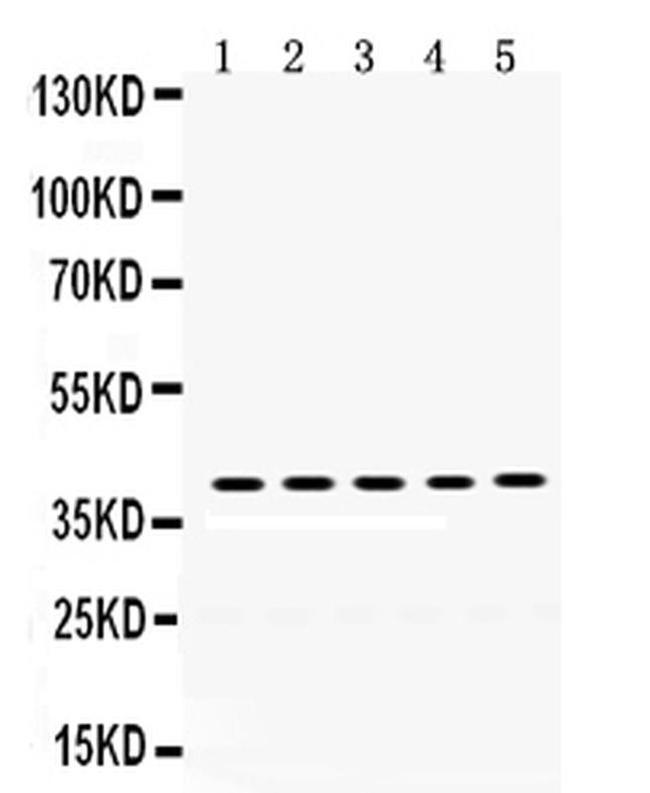 Oncostatin M Antibody in Western Blot (WB)