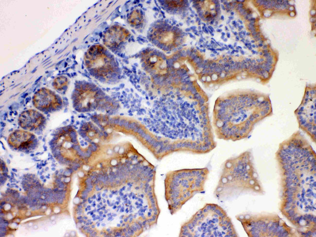 EBP1 Antibody in Immunohistochemistry (Paraffin) (IHC (P))