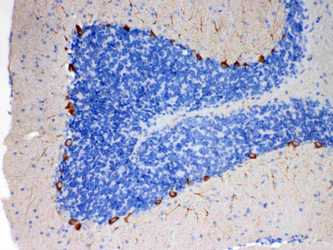 EBP1 Antibody in Immunohistochemistry (Paraffin) (IHC (P))